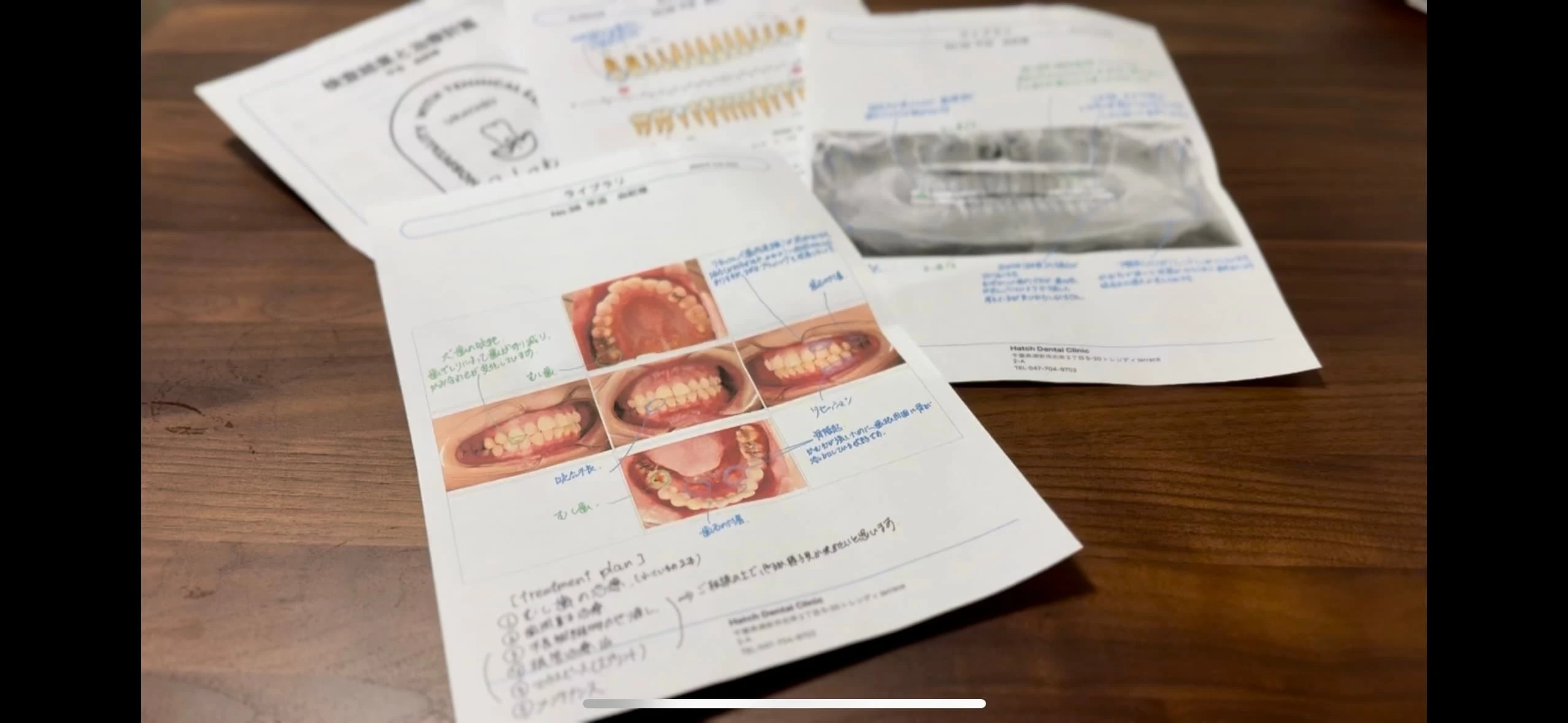 最新の予防技術